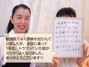 お客様のお喜びの声（敏感・乾燥・赤味）50代