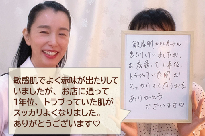 お客様のお喜びの声（敏感・乾燥・赤味）50代